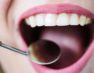 Παγκόσμια Ημέρα Στοματικής Υγείας: Η Ελληνική Οδοντιατρική Ομοσπονδία υπενθυμίζει  τους κανόνες της στοματικής υγείας